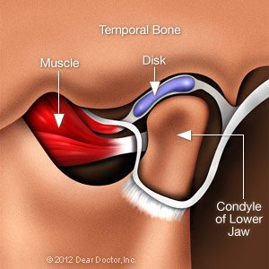 Causes of Tmd
