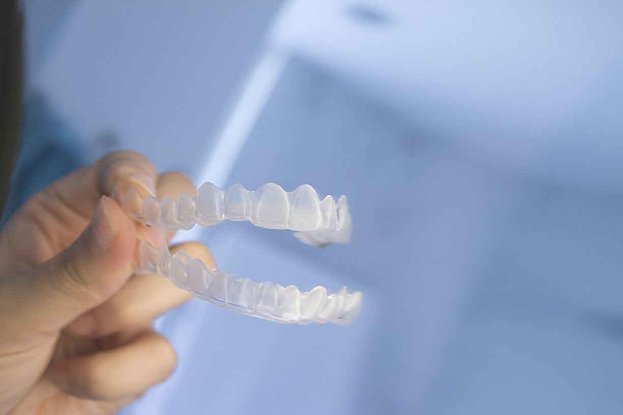 Cherokee Dental Professionals Guide to Invisalign in Jacksonville – What You Need to Know_FI