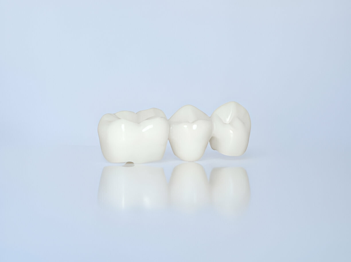 How to Care for Your Dental Crowns: Tips from Cherokee Dental Professionals in Jacksonville_FI