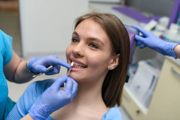 Comparing Porcelain Veneers to Teeth Whitening in Jacksonville, TX: Which Is Right for Your Smile?