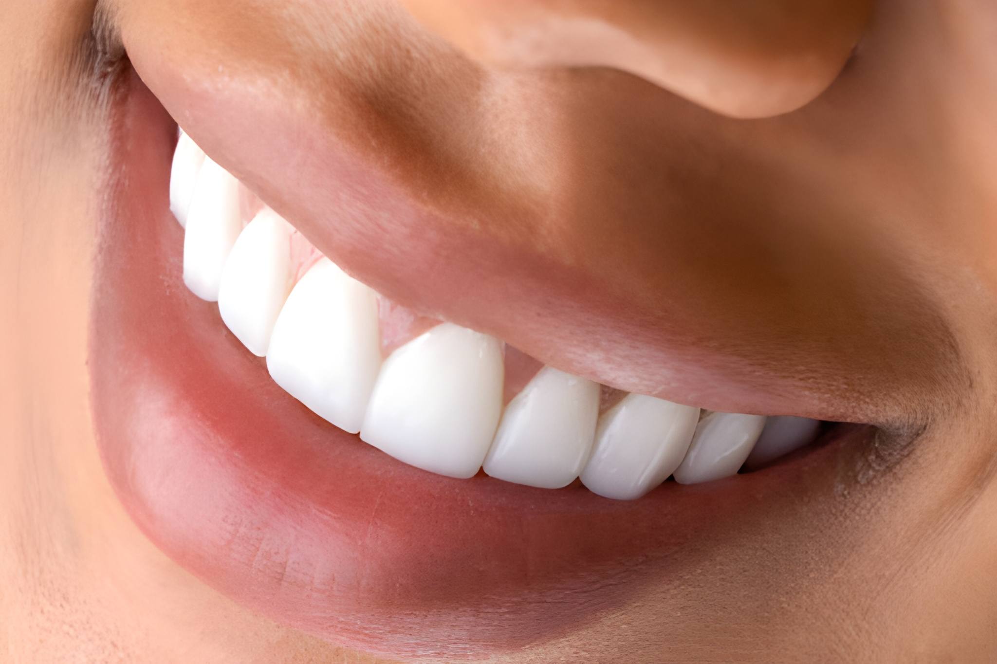 From Stained to Stunning: Teeth Whitening Results at Cherokee Dental Professionals_FI