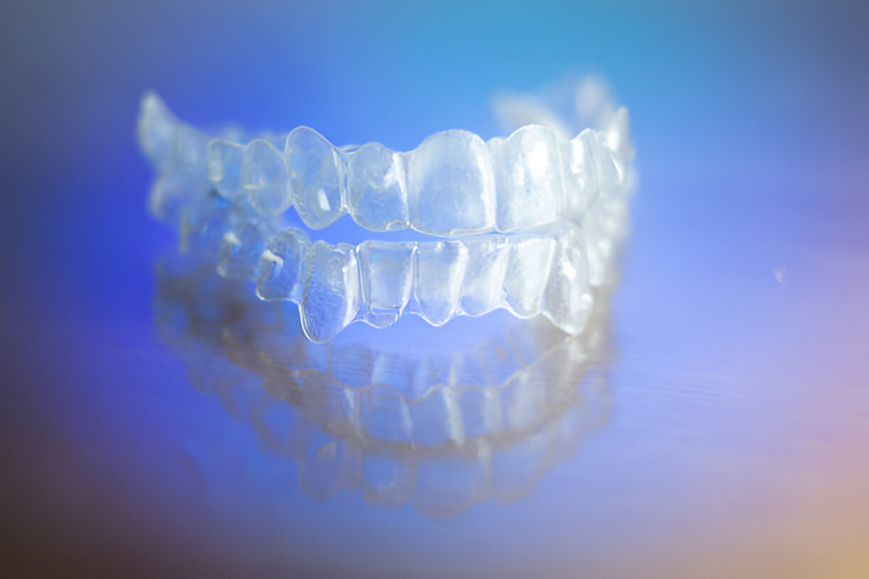 Invisalign in Jacksonville, TX: Key Benefits Explained by Your Dentist_FI